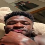 Vinicius Junior méconnaissable après une opération du visage